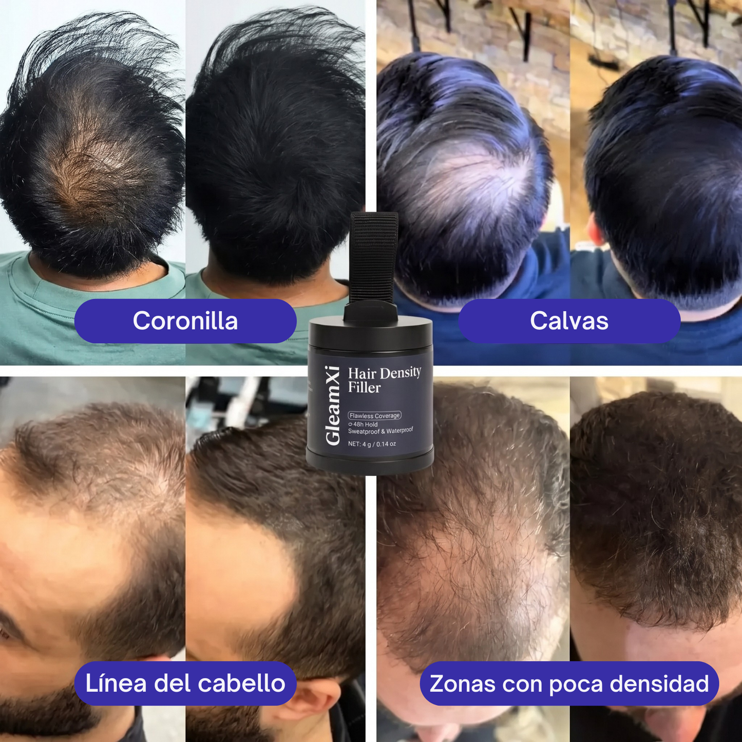 GleamXi Hair Density Filler
