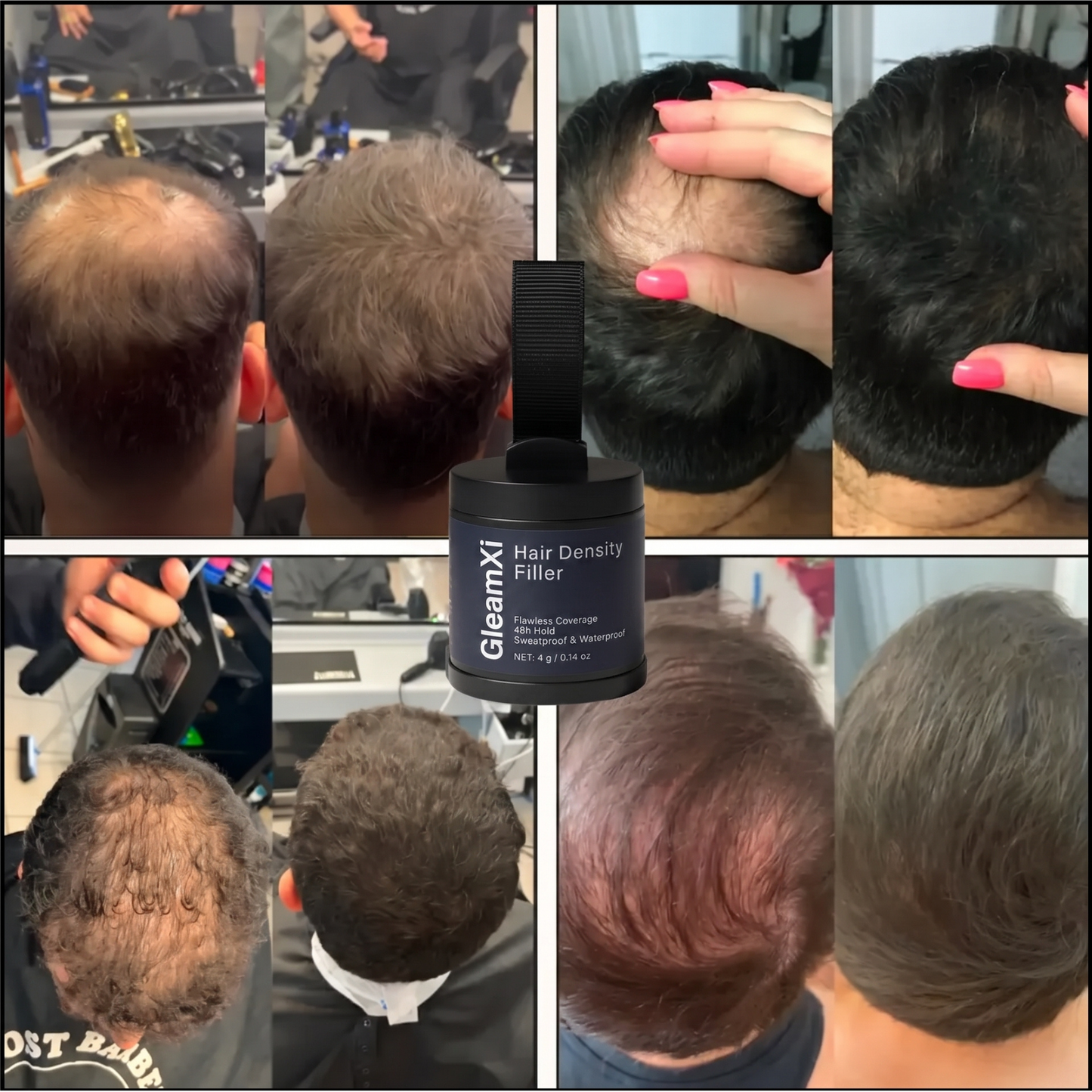 GleamXi Hair Density Filler