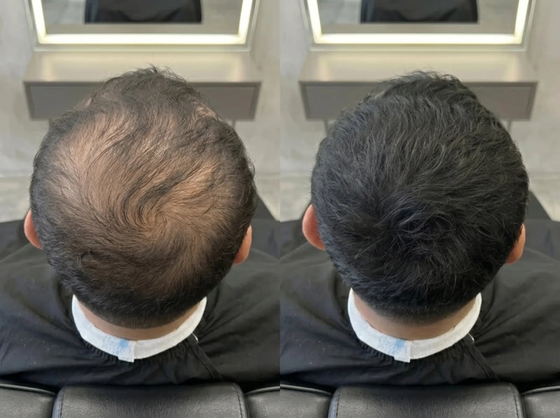 Mateo M. Sevilla before and after results