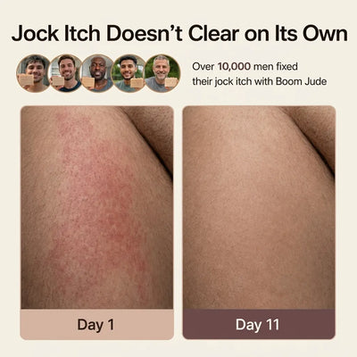 BoomJude Antifungal Soap