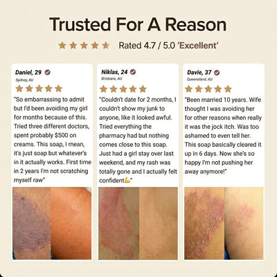 BoomJude Antifungal Soap