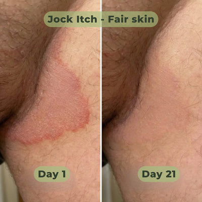 BoomJude Antifungal Soap